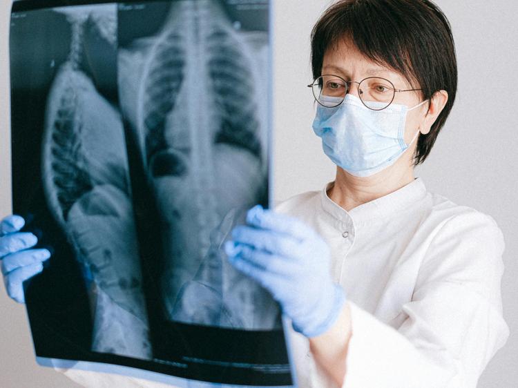 肺脓肿精准诊断与护理：影像检查+体位引流方案