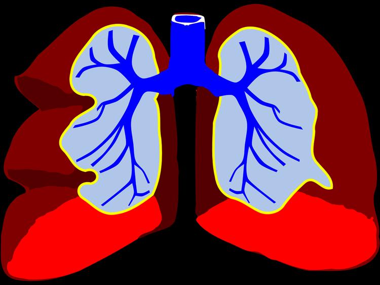 肺癌疼痛有多难熬？科学解读与应对策略
