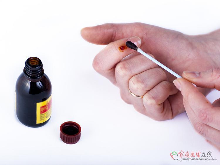 碘伏美白祛痘防脱发都是谣言,别信! 碘伏美白祛痘防脱发是谣言别信